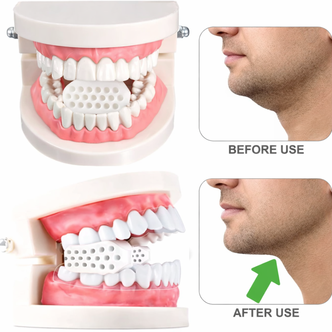 Ejercitadores de Mandíbula con 3 Pares
